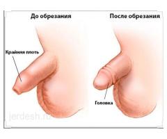 Медициналык жардам саат 9:00дон 21:00го чейин! Тел: 89265537655: фото 3
