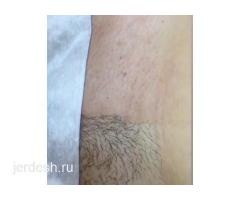 АКЦИЯ! ШУГАРИНГ. ПМ.: фото 3