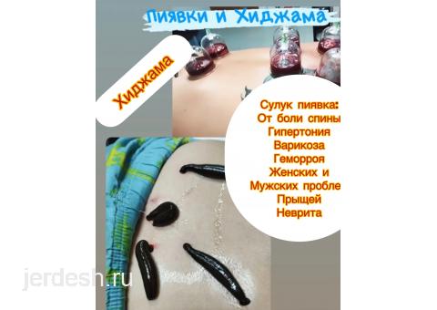 Хиджама Сулук инъекции опыт 12 лет: фото 1