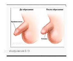 МЕД-ЦЕНТР. ГИНЕКОЛОГ. УРОЛОГ. АЛЛЕРГОЛОГ, ХИРУРГ (обрезание/суннотко отургузуу): фото 3