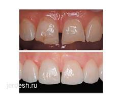 Медицинские услуги: стоматология, анализы, УЗИ, ЭКГ, капельницы: фото 4