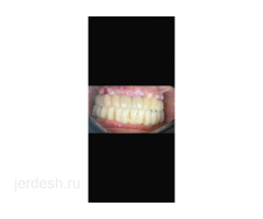 Стоматолог-хирург рядом с м. Добрынинская: фото 2