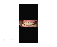 Стоматолог-хирург рядом с м. Добрынинская: фото 3