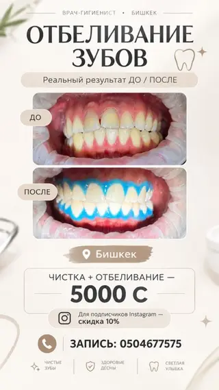 Профессиональная чистка и отбеливание зубов за 4500 сом